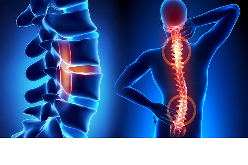 Факторы, способствующие проявлению боли в спине