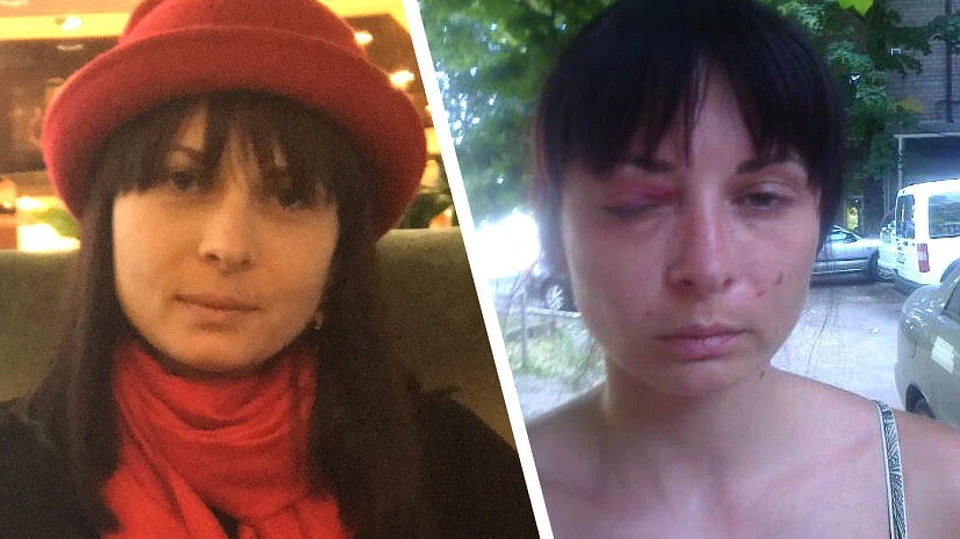 Дарья Мастикашева до и после пыток в СБУ. Фото: Фейсбук адвоката Валентина Рыбина