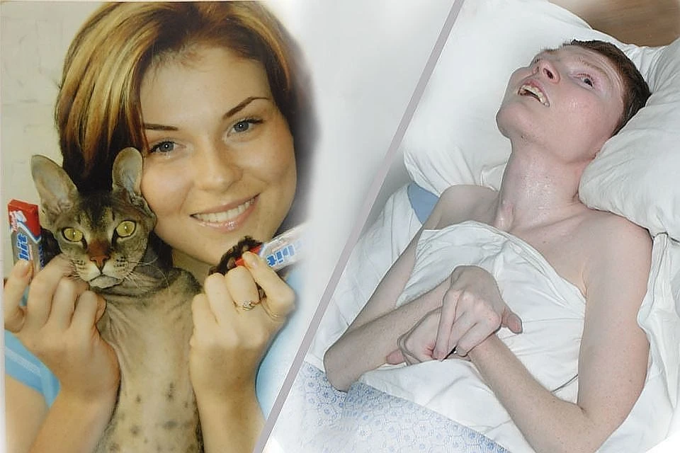 Беда случилась с Ириной Пекарской, когда ей было 22 года. Фото слева сделано незадолго до пожара.