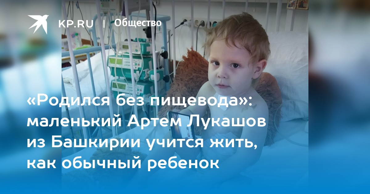 Родился без. Дети рожденные без пищевода. Ребенок рожден без пищевода. Люди рожденные без пищевода. Девочка родилась без пищевода.