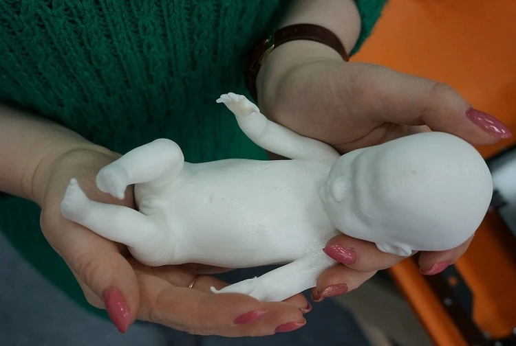 Распечатали ребенка: в Екатеринбурге создали 3D-модель еще не родившегося малыша