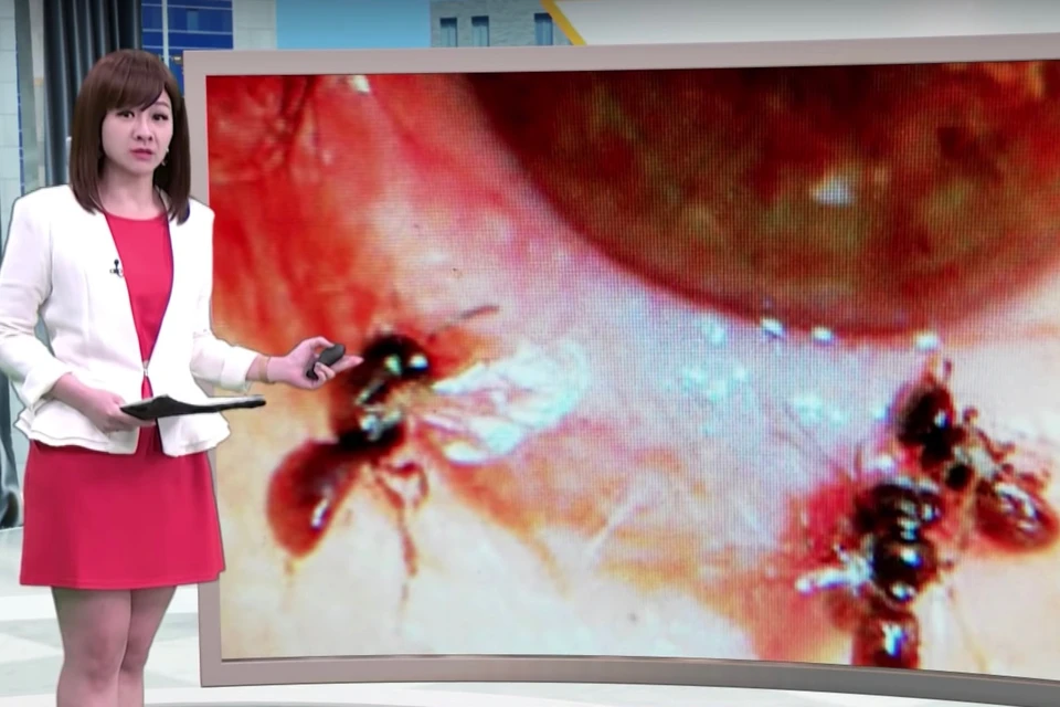 У пациентке Хи и её пчёлах рассказали все телеканалы в Тайване