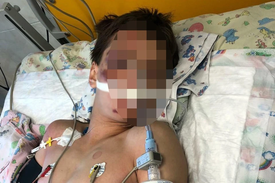 Мальчик находится в коме, его состояние стабильно тяжелое