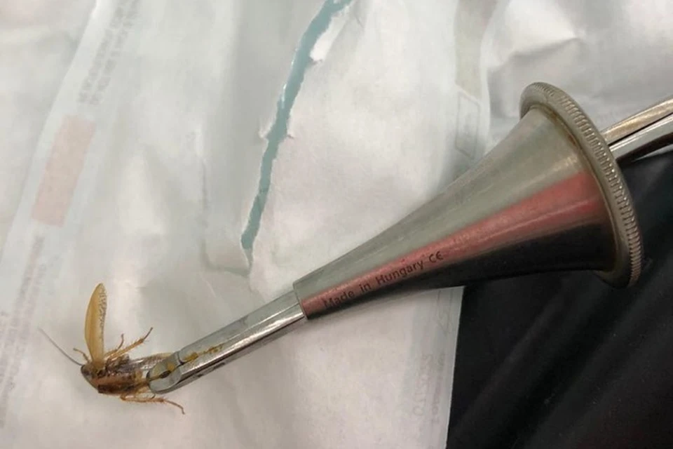 Врачи вытащили из уха кузбассовца насекомое. ФОТО: Областная клиническая больница/Instagram