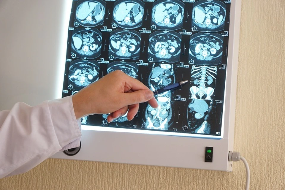 Медики сделали компьютерную томографию и ужаснулись, обнаружив в теле мужчины инородный предмет