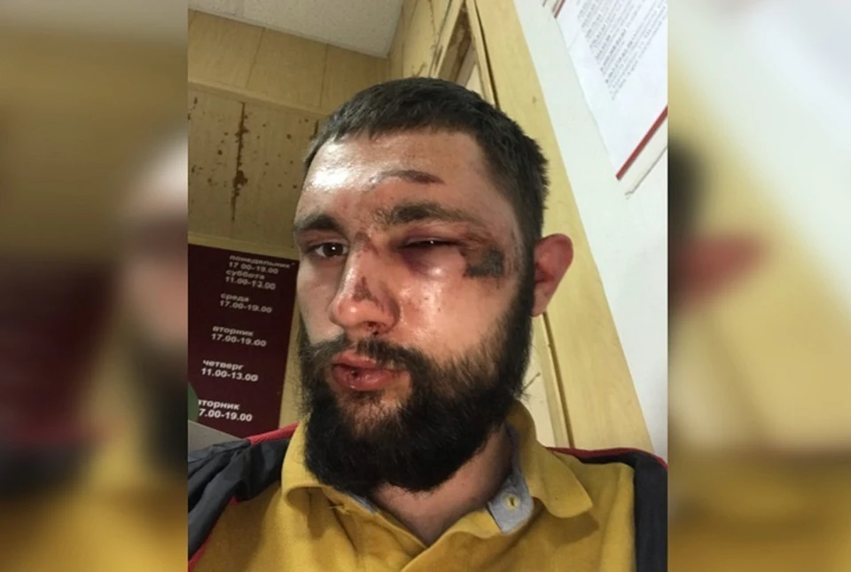 Фото: представлено героем публикации