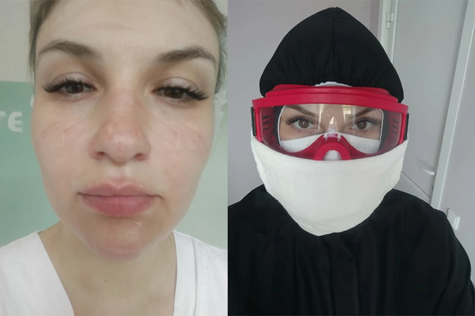 Фото "до" и "после"