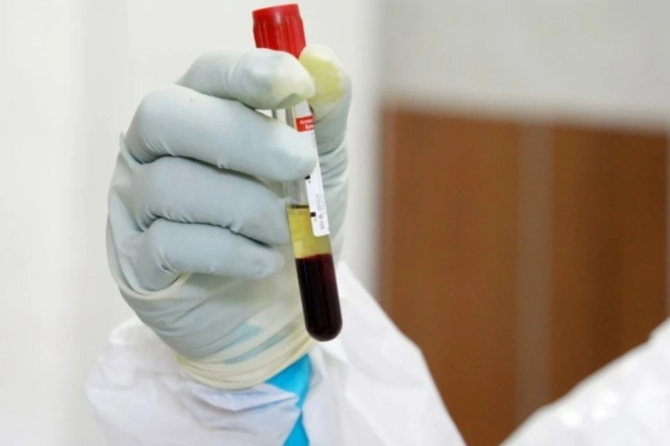 С начала пандемии в Крыму коронавирусом заболело 3808 человек