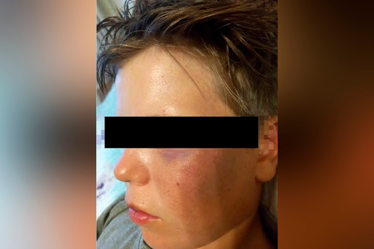 9-летний Иван получил побои от сверстников за свою национальность и вероисповедание. Фото: 24.kg