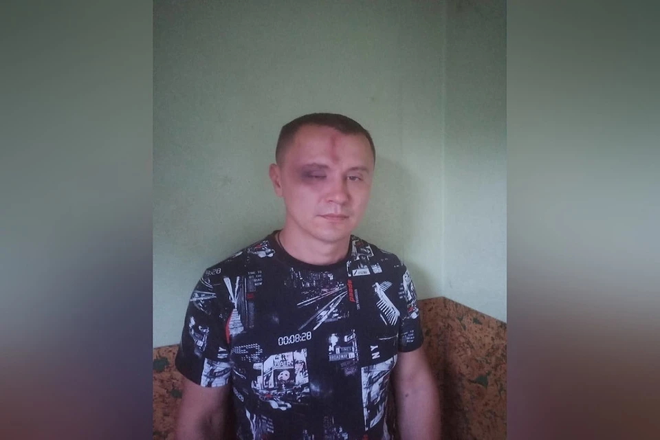 Новосибирская полиция проводит проверку после избиения дружинника толпой хулиганов. Фото: предоставлено Ростиславом Антоновым.