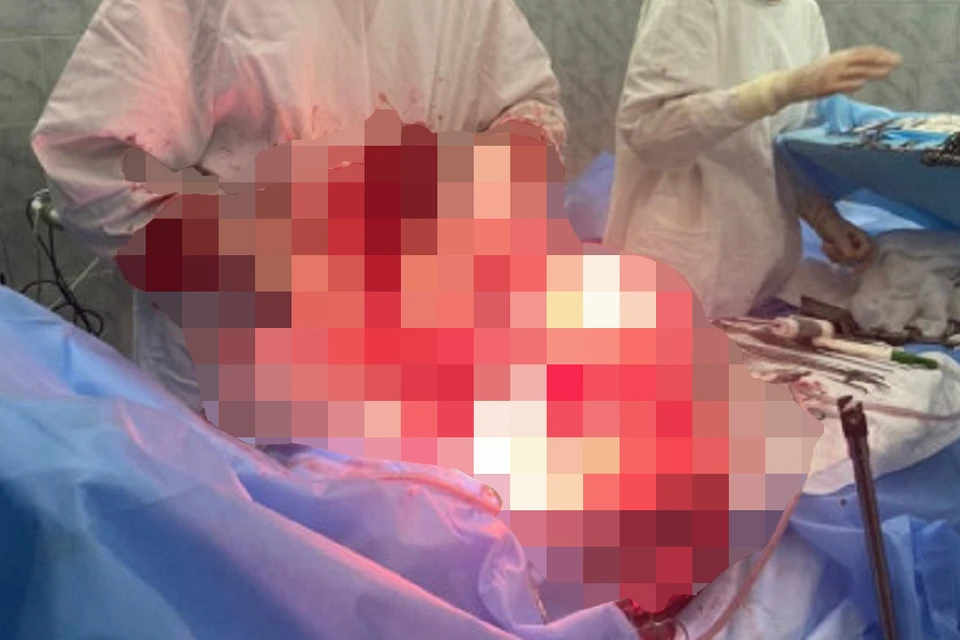 Одна из опухолей оказалась злокачественной. Фото: https://zdrav.nso.ru/