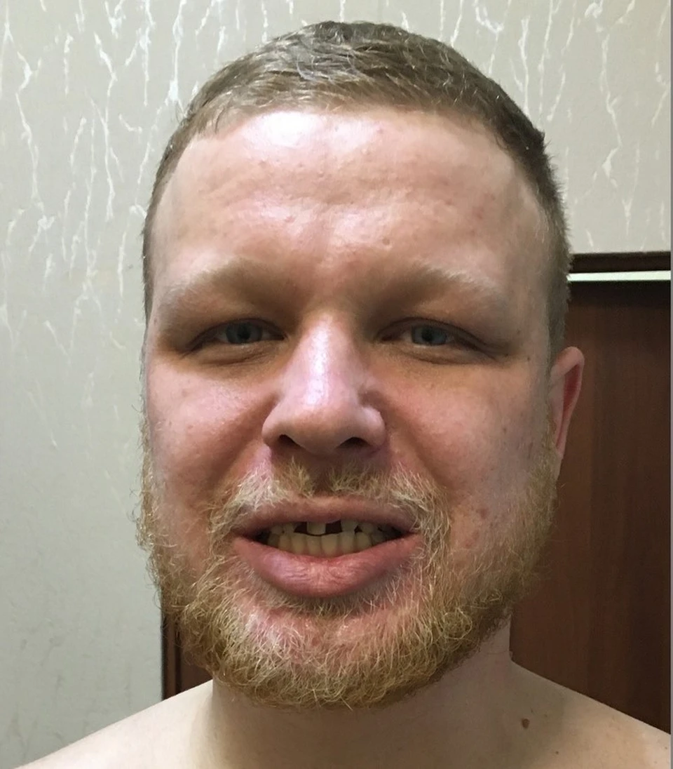 Расследуется уголовное дело в отношении Федотова Виктора Сергеевича, 1993 года рождения. Он обвиняется в совершении серии изнасилований.