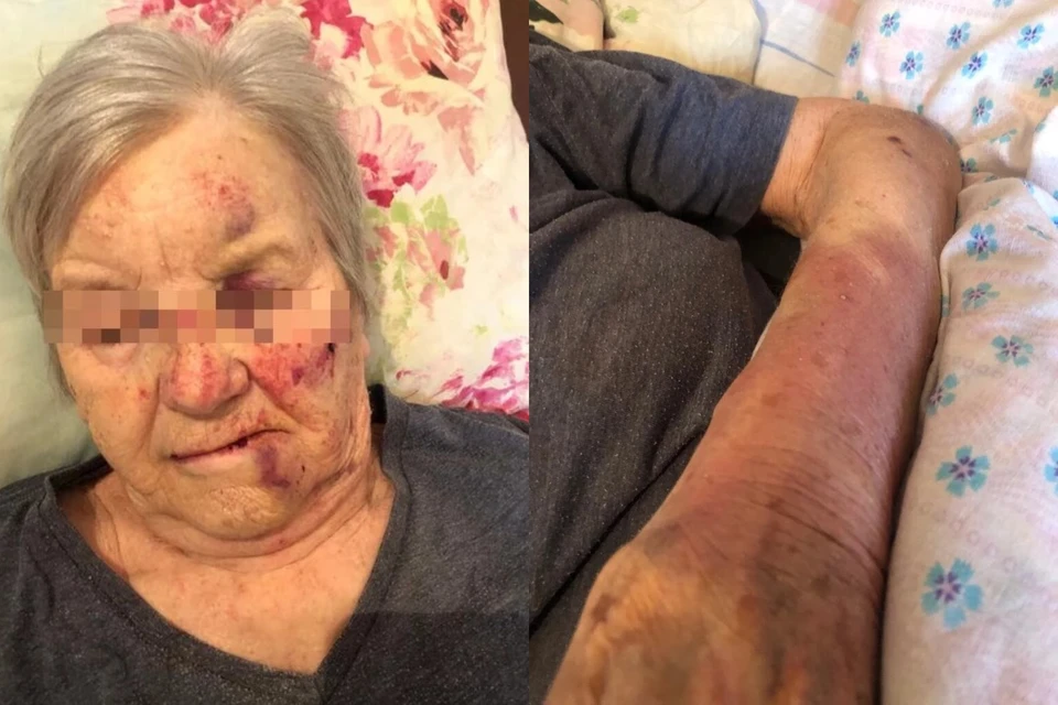 Скорую и полицию вызвали только на утро. Фото: Сибкрай.ru