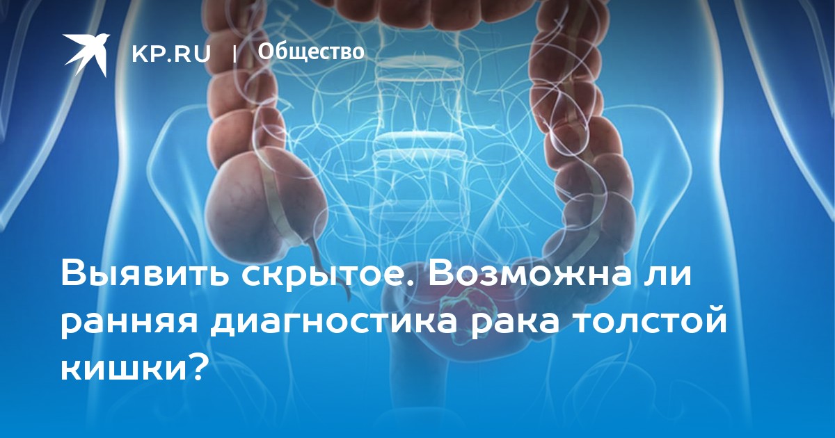 Симптомы рака толстого кишечника. Онкология толстой кишки. Диагностика заболеваний толстой кишки.