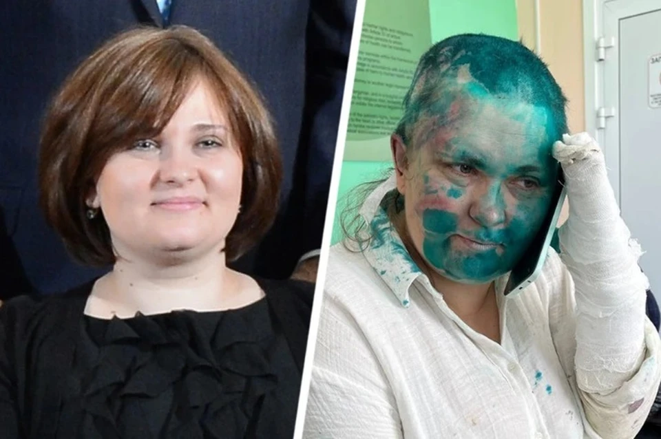 Журналистка Елена Милашина до и после нападения. Фото: телеграм-канал Ксении Собчак