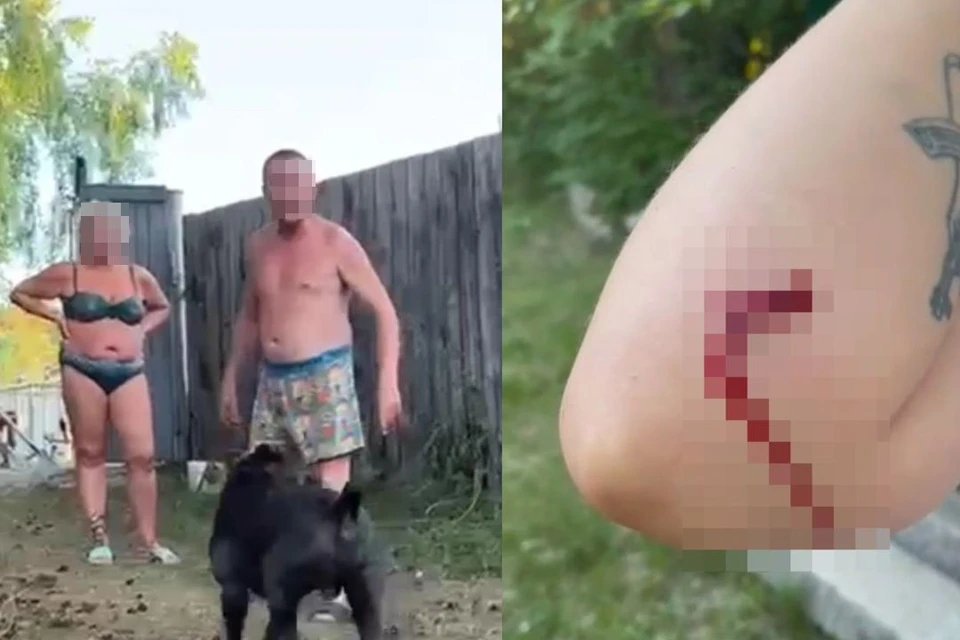 Собака прокусила девушке руку. Фото: предоставлено Миланой/скриншот из видео