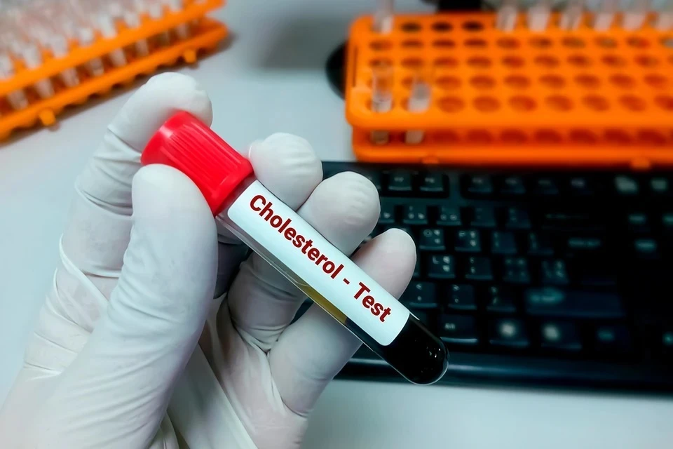 Стало известно, как часто необходимо проверять уровень холестерина