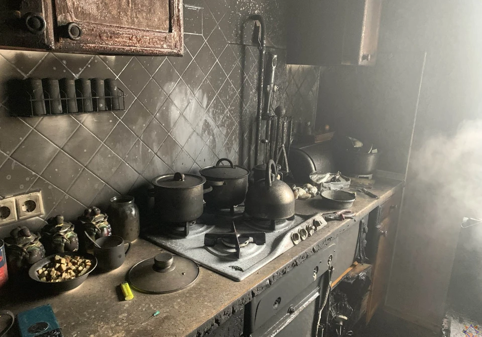 Хозяин квартиры получил ожоги. Фото: mchs.gov.by
