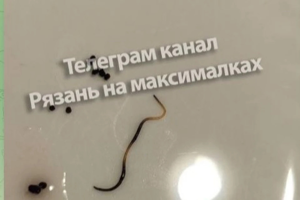 Рязанцы обнаружили червя паразита в роллах