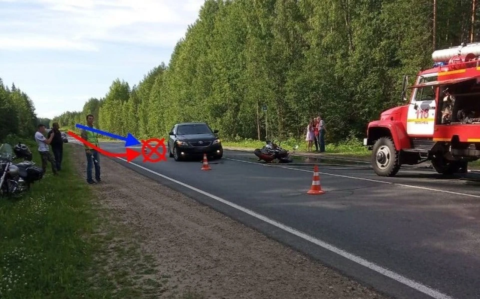 Сыктывкарец три года доказывал свою невиновность в ДТП, в котором он потерял ногу.