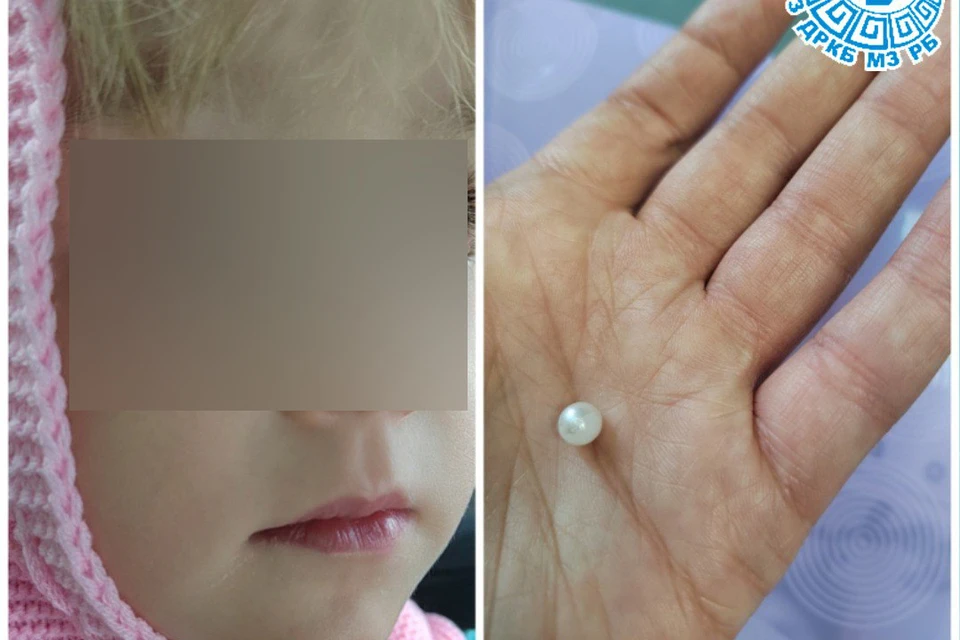 Зрение трехлетней девочки сохранила врач-офтальмолог из Бурятии. Фото: тг-канал ДРКБ Бурятия