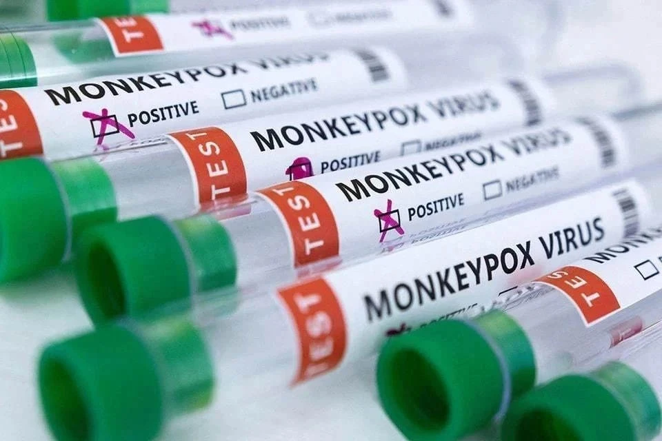 Жителей Ганы попросили воздержаться от поцелуев и секса из-за оспы обезьян
