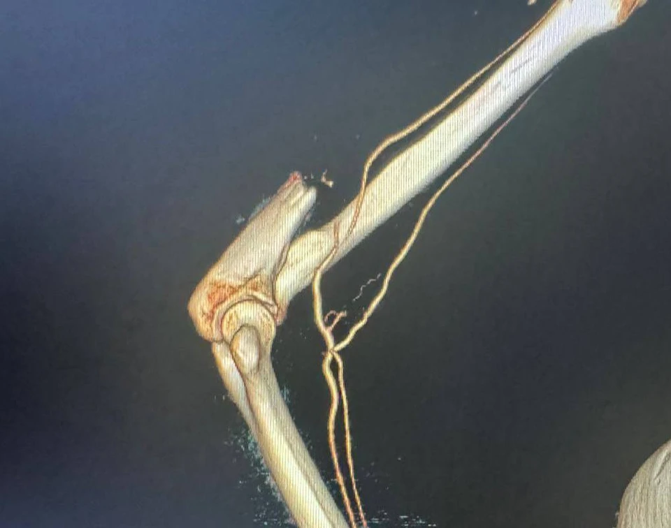 Фото: телеграм-канал Дмитрия Беглова.