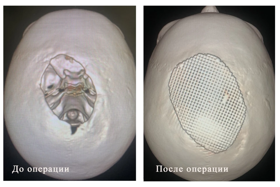 Мальчик провел в больнице 105 (!) дней. Фото: Ивано-Материнская детская клиническая больница.