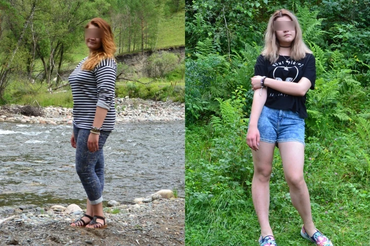 «Стали выпадать волосы, крошиться зубы»: одиннадцатиклассница довела себя до анорексии из-за травли перед школьным выпускным
