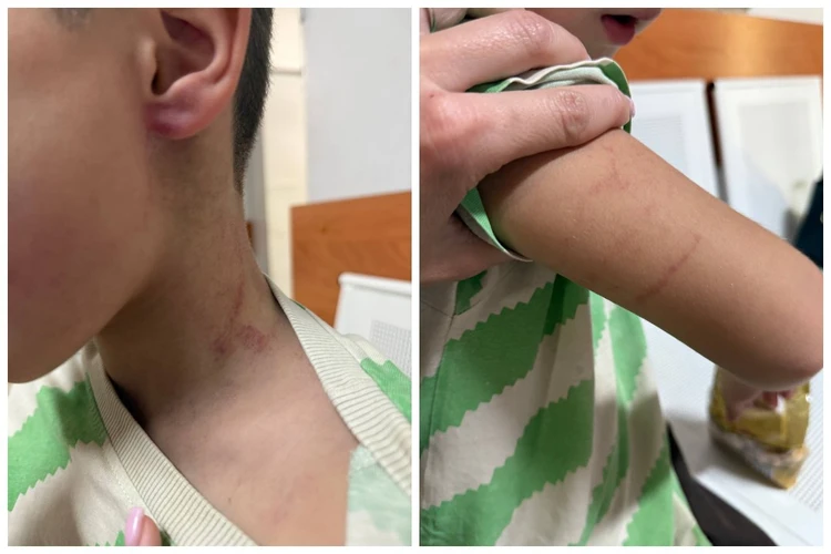 «Тренер схватил его за шею и поднял вверх»: узнав, что произошло с 6-летним сыном в детсаду, мать была в шоке