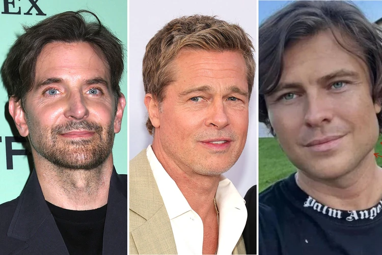 Прохор Шаляпин стал похож на Кена, а Брэдли Купера назвали восковым: результаты пластических операций звездных мужчин