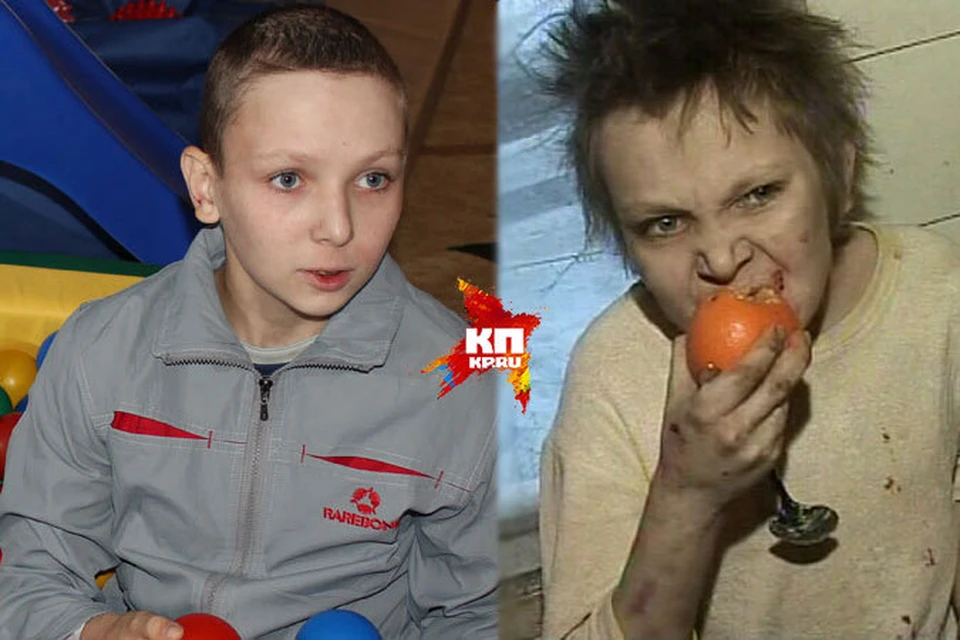 Женя Барсуков. Фото слева сделано буквально на днях. А фото справа - этот же мальчик 3 года назад.