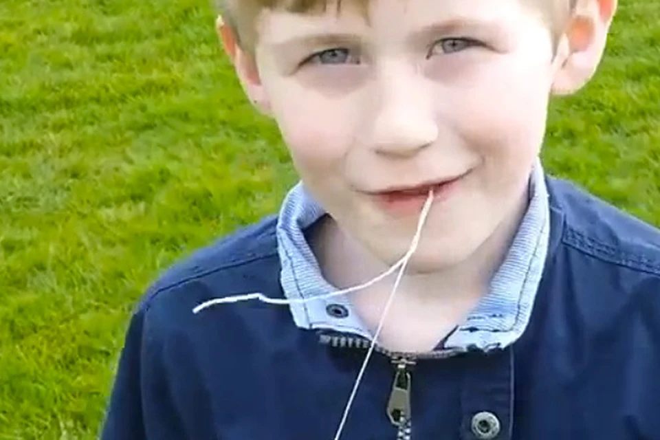 В Ирландии восьмилетнему мальчику выдернули зуб при помощи квадрокоптера