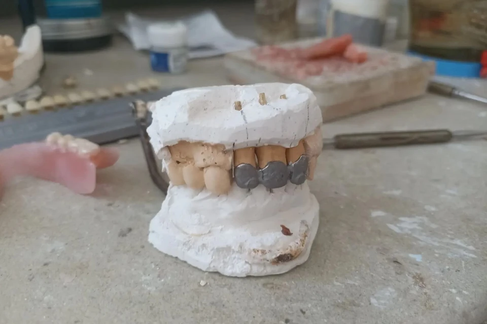 Заготовка для металлокерамической коронки.